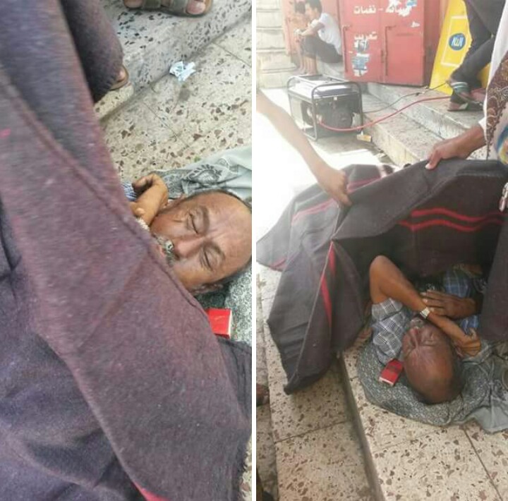 وفاة مواطن في الرصيف بسبب انعدام الغسيل الكلوي في تعز