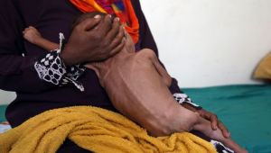 الصليب الأحمر: ملايين اليمنيين ينامون جوعى كل ليلة