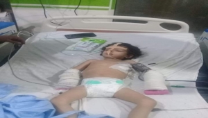 إب.. تعرض طفل لعنف أسري وعمليات تعذيب وحشية