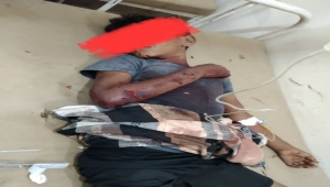 إصابة عشرة أطفال بإنفجار مقذوف من مخلفات الحرب جنوبي الحديدة