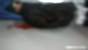 تعز.. مقتل طفل برصاص راجع في جبل حبشي