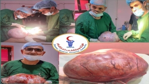 استئصال كيس يزن 14 كغم من رحم مريضة بذمار