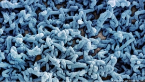 أثيوبيا تؤكد تفشي وباء "فيروس ماربورغ" والصحة العالمية تحذر