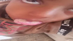 مناشدات عاجلة في الضالع جراء تفشي وباء "فطريات اللسان" بين أطفال منطقة "تورصة"