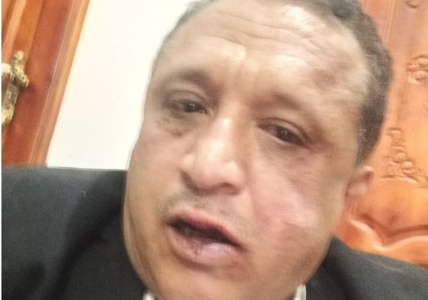 منظمة حقوقية تدين اعتداء الحوثيين على الصحفي 