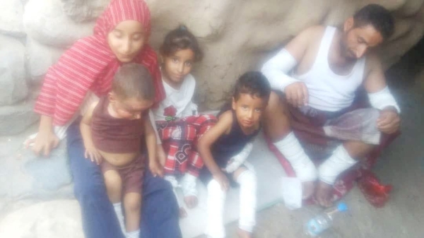 ‫احتراق أسرة كاملة إثر انفجار اسطوانة غاز في محافظة إب