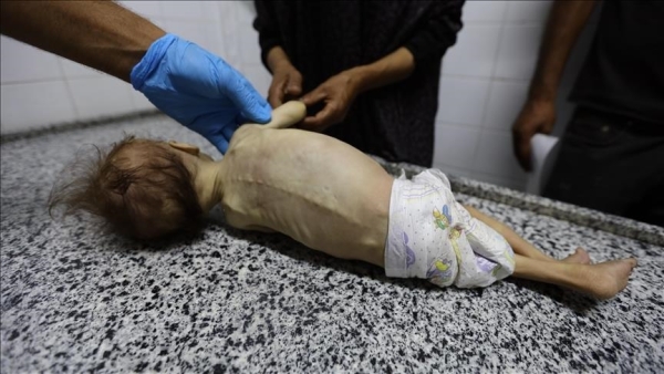 حكومة غزة: الموت جوعا يهدد 650 ألف طفل دون الخامسة بالقطاع