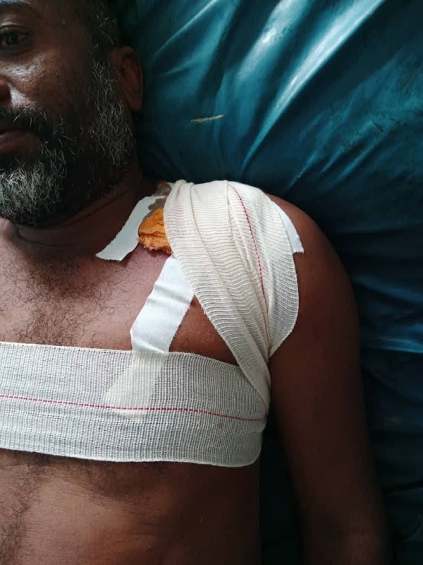 إصابة إثنين من عمال مصنع إسمنت الوحدة برصاص مسلح في أبين