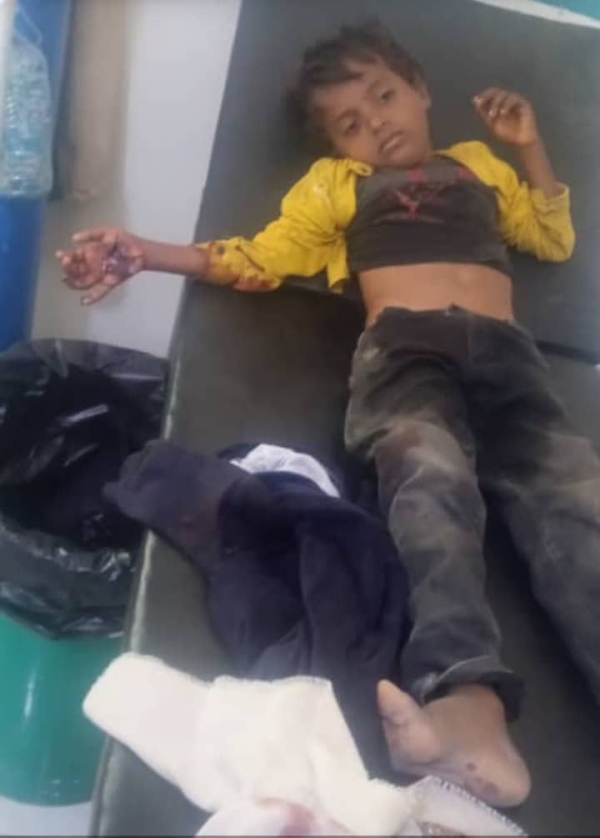 تعز.. إصابة طفل جراء انفجار 