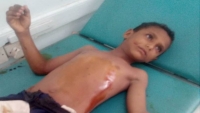 منظمة حقوقية تدين هجومًا حوثيًا استهدف أطفالا جنوبي الحديدة